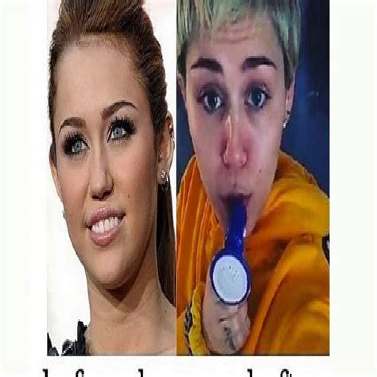 Miley Cyrus Addicted To Prescription Drugs, Friends Fear For Her Life: Will She Check Into Rehab Before Time Runs Out?