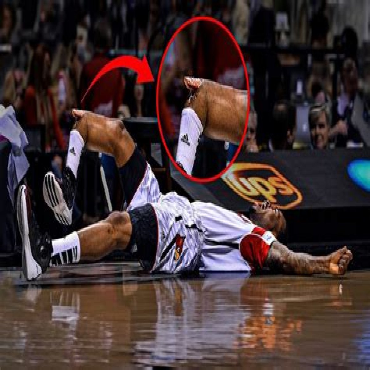 What Happened To Israel Gutierrez Eye Injury And Face? NBA Reporter Wearing A Band-Aid Explained